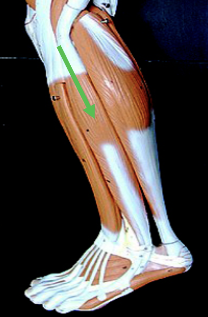 <p>Identify the muscle indicated by the pointer.</p>