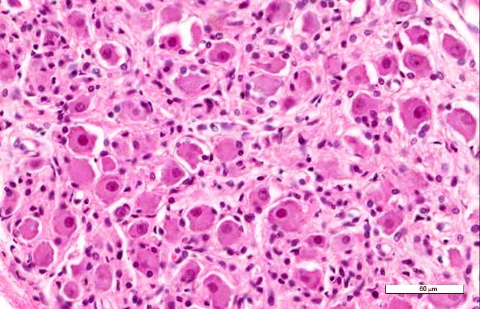 <p>Identifica la plaquita</p>