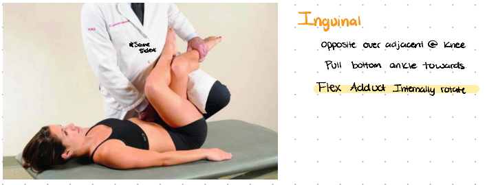 <p><span style="background-color: transparent;">F ADduct Internally Rotate</span></p><ol><li><p><span style="background-color: transparent;">Tender point is located on the lateral aspect of the pubic tubercle; associated with the attachment of the inguinal ligament and/or pectineus muscle</span></p></li><li><p><span style="background-color: transparent;">Standing on the same side of the tender point</span></p></li><li><p><span style="background-color: transparent;"><strong>Cross the patient’s thighs</strong> opposite over adjacent. flex hips/knees bilaterally and place legs on physician’s thigh</span></p></li><li><p><span style="background-color: transparent;">Pull patient’s ipsilateral leg towards physician to induce adduction and internal rotation of the hip</span></p></li><li><p><span style="background-color: transparent;">Fine tune with more/less hip flexion, internal rotation and adduction</span></p></li></ol><p></p>