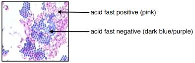 <p>acid fast stain</p>