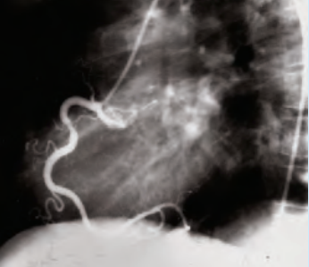 <p>Label the coronary angiogram </p>