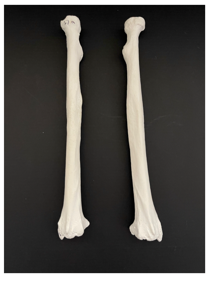 <p>Identify the name of the bone that is being depicted in the image.</p>