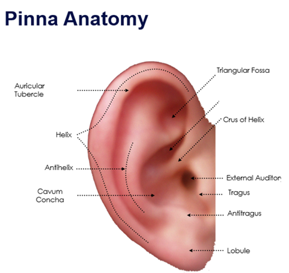 <p>label missing part</p>
