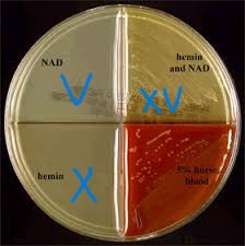 <p><strong>ALA porphyrin test</strong></p><ul><li><p>detects the organism’s ability to produce heme</p></li></ul><p><strong>Quad plates</strong></p><p><strong>biochemical</strong></p><ul><li><p>fermentation, indole, urease</p></li></ul><p></p>