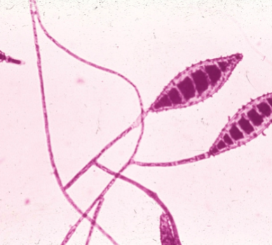 <p>“spindle-shaped” macroconidia w/ tapered ends</p>