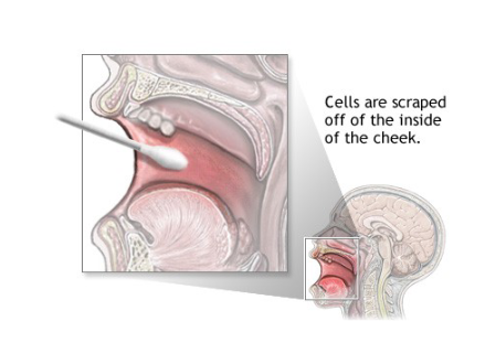 <p>The inside of the cheek.</p>