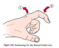 <p>Differentiates tight intrinsic muscles from capsule contracture at the MCP and PIP joints.</p>