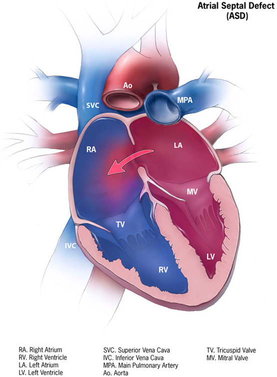 <p>ASD and location</p>