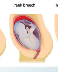 <p>Butt first with legs up</p>