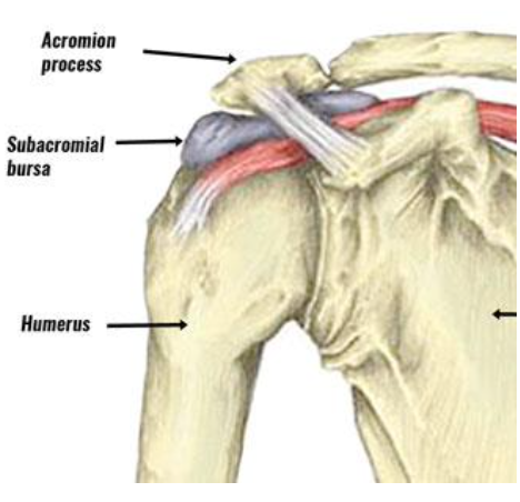 <p>Subacromial Bursitis</p>