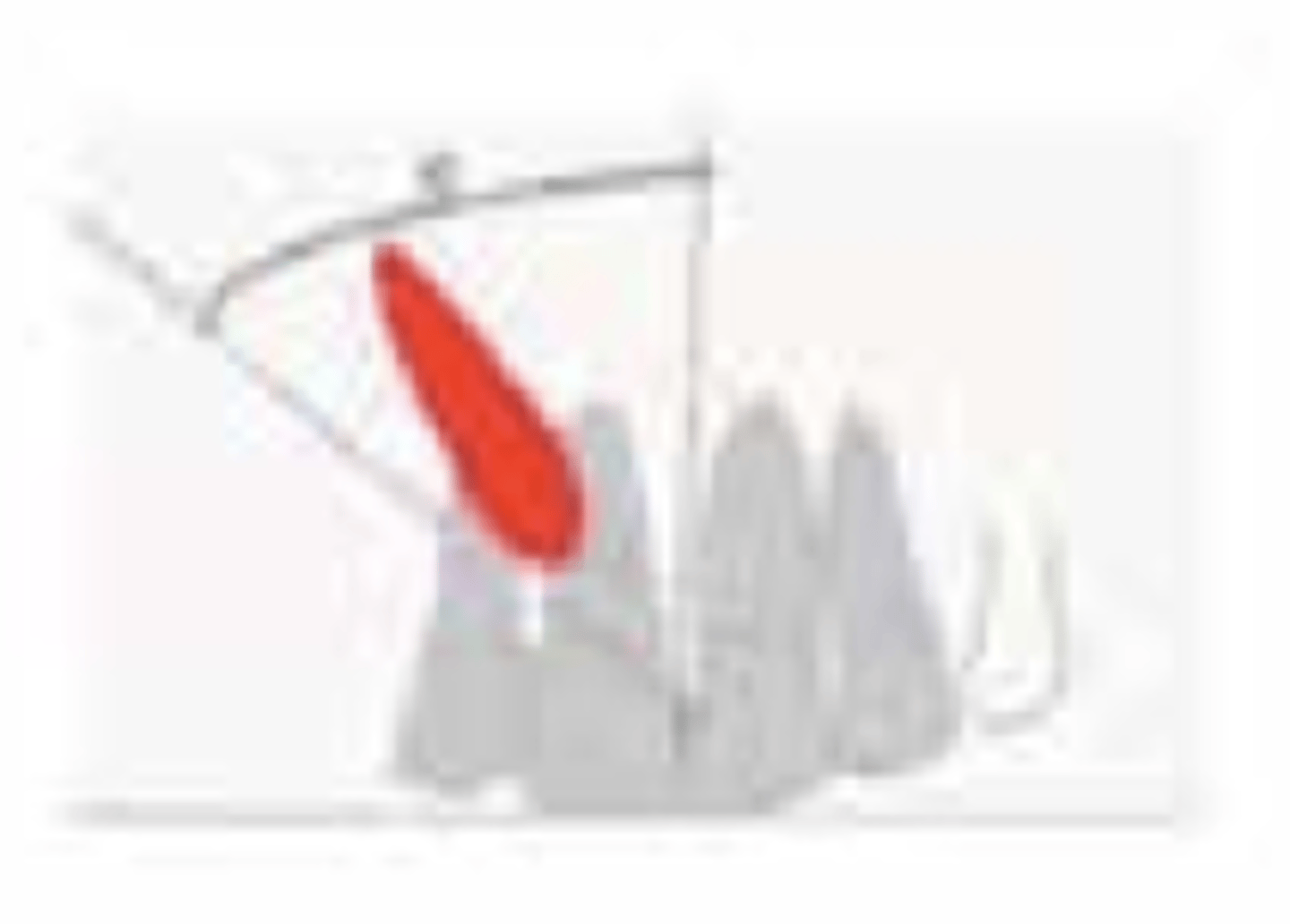 <p>What is the prognosis?</p><p>- Angulation: 16-30°</p>