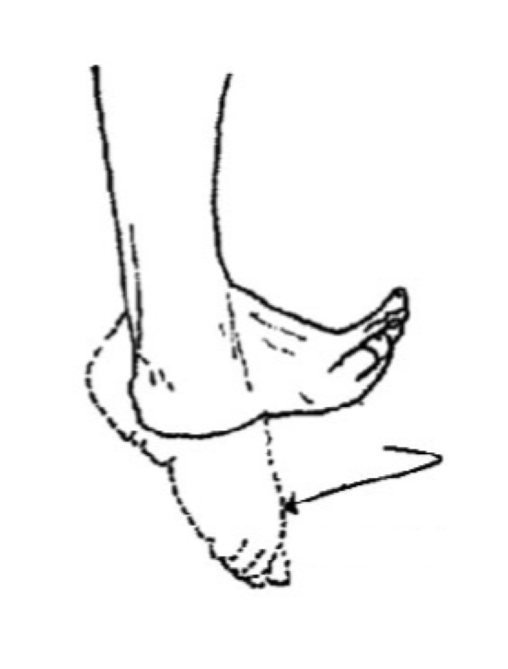 <p>name the muscle action</p>