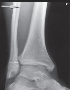 <p>Which aspect of the ankle is best visualized?</p>