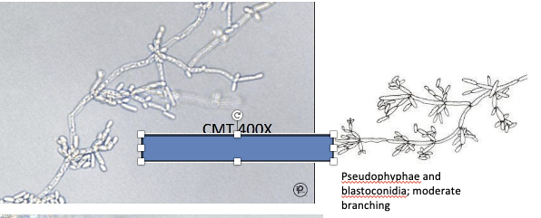 <p>ID the type of yeast </p>