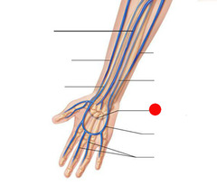 <p>refers to the palm of the hand; in the anatomic position, the same as the anterior or ventral surface of the hand</p>