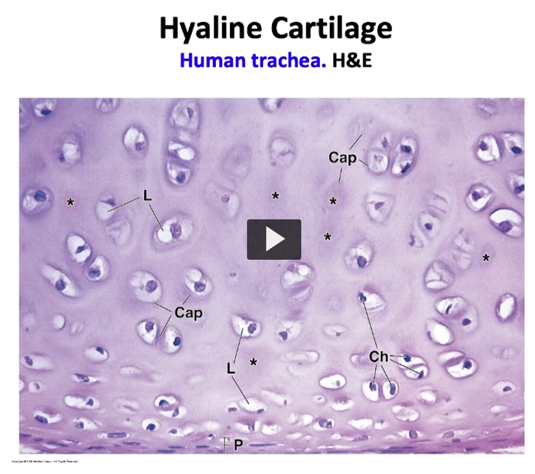 <p>I placed this interesting image for you to review. </p><p>Observe how the asterisk indicates intraterritorial matrix. The L is for lacunae, which is where every chondrocyte is. </p><p>Basically, we have a dark area surrounding this group of chondrocytes, which is the territorial matrix. This is an isogenous group. </p><p>Over here, I have the part that correspondss to the perichhondrium A. A good image to review. </p>