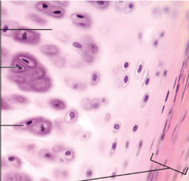 <p>Hyaline Cartilage</p>