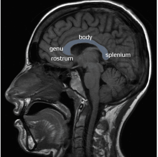 <p>Name the highlighted part of the brain</p>