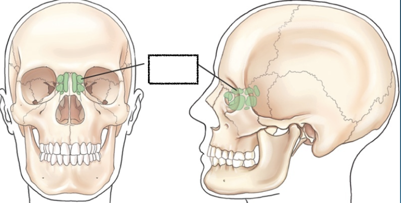 <p>What is this?</p>