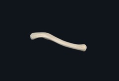<p>If this bone was cut longitudinally what plane would cross the cut?</p>