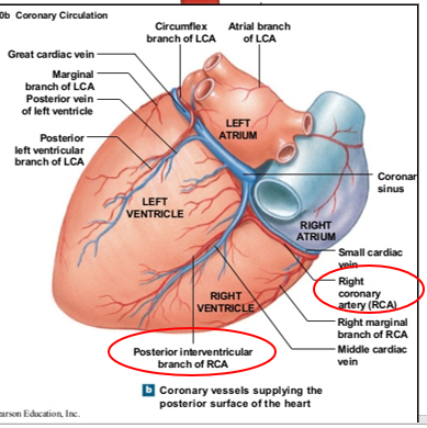 <p>Whether the right or left coronary circulation gives rise to the PDA.</p>