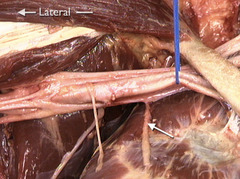 <p>In this anterior view of the right elbow and forearm, identify the nerve indicated by the arrows.</p>