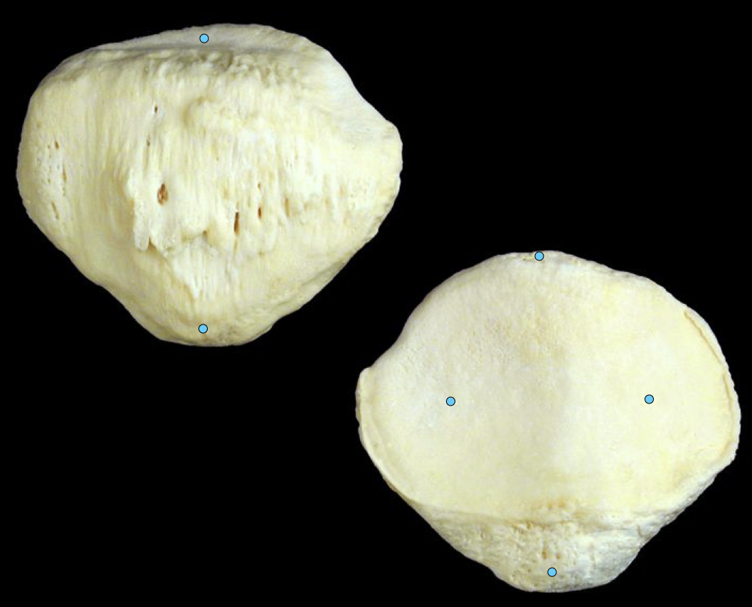 <p>kneecap</p>