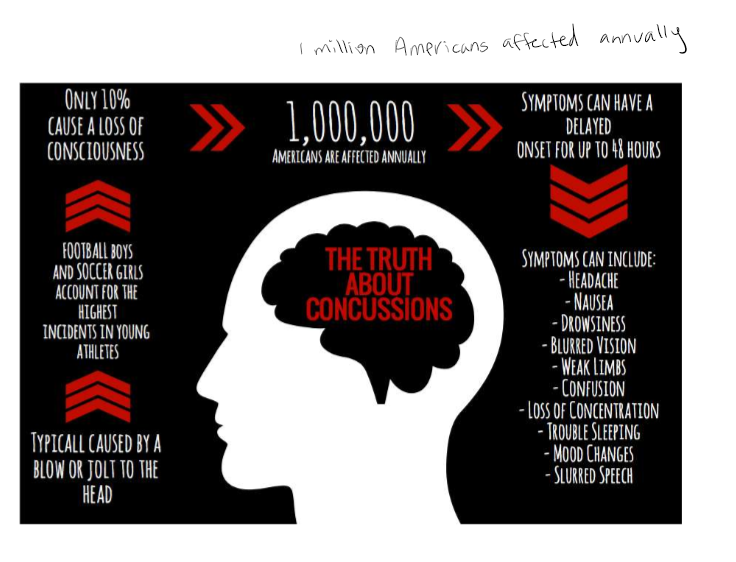 <p>Blurred or double vision; seeing stars; sensitivity to light or noise; headache dizziness, or balance problems; nausea, vomiting; trouble sleeping, fatigue; confusion, difficulty remembering, difficulty concentrating, or loss of consciousness. </p>