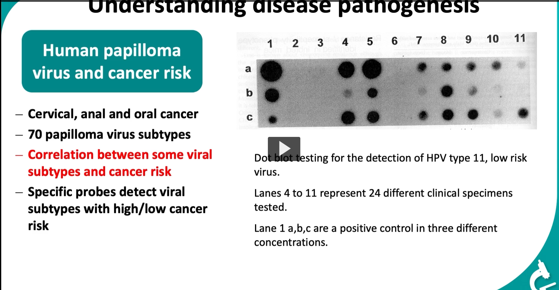 <figure data-type="blockquoteFigure"><div><blockquote><p><strong>Different HPV subtypes have different cancer risks, and molecular probes can detect which subtype is present.</strong></p></blockquote><figcaption></figcaption></div></figure><p><span data-name="point_right" data-type="emoji">👉</span> This lets us:</p><ul><li><p><strong>diagnose infection</strong></p></li><li><p><strong>predict cancer risk</strong></p></li></ul><div data-type="horizontalRule"><hr></div><p> <span data-name="microbe" data-type="emoji">🦠</span> Part 1: HPV and cancer What is HPV? </p><ul><li><p><strong>Human papillomavirus (HPV)</strong> = a DNA virus</p></li><li><p>Infects epithelial cells (skin, mucosa)</p></li></ul><div data-type="horizontalRule"><hr></div><p> Diseases associated: </p><ul><li><p><strong>Cervical cancer</strong></p></li><li><p><strong>Anal cancer</strong></p></li><li><p><strong>Oral (oropharyngeal) cancer</strong></p></li></ul><div data-type="horizontalRule"><hr></div><p> Key concept: </p><ul><li><p>There are <strong>~70+ HPV subtypes</strong></p></li><li><p>NOT all are dangerous</p></li></ul><p><span data-name="point_right" data-type="emoji">👉</span> Two categories:</p><ul><li><p><strong>Low-risk types</strong> (e.g., HPV 6, 11) → warts</p></li><li><p><strong>High-risk types</strong> (e.g., HPV 16, 18) → cancer</p></li></ul><div data-type="horizontalRule"><hr></div><p> <span data-name="red_circle" data-type="emoji">🔴</span> Critical point on the slide </p><figure data-type="blockquoteFigure"><div><blockquote><p>“Correlation between some viral subtypes and cancer risk”</p></blockquote><figcaption></figcaption></div></figure><p><span data-name="point_right" data-type="emoji">👉</span> Meaning:</p><ul><li><p>The <strong>specific DNA sequence (genotype)</strong> determines how dangerous the virus is</p></li></ul><div data-type="horizontalRule"><hr></div><p> <span data-name="test_tube" data-type="emoji">🧪</span> Part 2: How we detect this (dot blot) </p><p>This slide shows a <strong>dot blot</strong> (a simpler version of Southern blot).</p><div data-type="horizontalRule"><hr></div><p> <span data-name="microscope" data-type="emoji">🔬</span> What is a dot blot? </p><ul><li><p>DNA samples are placed as <strong>dots</strong> on a membrane</p></li><li><p>No size separation (unlike gel electrophoresis)</p></li><li><p>A <strong>probe</strong> is added</p></li></ul><p><span data-name="point_right" data-type="emoji">👉</span> If the target HPV DNA is present → dot becomes <strong>dark</strong></p><div data-type="horizontalRule"><hr></div><p> <span data-name="bar_chart" data-type="emoji">📊</span> Interpreting the image Layout: </p><ul><li><p>Columns labeled <strong>1–11</strong> = different samples</p></li><li><p>Rows <strong>a, b, c</strong> = different concentrations (controls)</p></li></ul><div data-type="horizontalRule"><hr></div><p> Controls (Lane 1): </p><ul><li><p><strong>a, b, c = positive control</strong></p></li><li><p>Show strong signals at different concentrations</p></li></ul><p><span data-name="point_right" data-type="emoji">👉</span> Confirms:</p><figure data-type="blockquoteFigure"><div><blockquote><p>The test is working properly</p></blockquote><figcaption></figcaption></div></figure><div data-type="horizontalRule"><hr></div><p> Clinical samples (Lanes 4–11): </p><ul><li><p>Each dot = one patient/sample</p></li></ul><p><span data-name="point_right" data-type="emoji">👉</span> Dark dot → <strong>HPV DNA present</strong><br><span data-name="point_right" data-type="emoji">👉</span> No dot → <strong>HPV not detected</strong></p><div data-type="horizontalRule"><hr></div><p> Important detail: </p><ul><li><p>This test is specifically detecting:</p><figure data-type="blockquoteFigure"><div><blockquote><p><strong>HPV type 11 (low-risk virus)</strong></p></blockquote><figcaption></figcaption></div></figure></li></ul><p>So:</p><ul><li><p>Positive result → patient has <strong>low-risk HPV</strong></p></li><li><p>Negative → no HPV 11 detected (could still have other types!)</p></li></ul><div data-type="horizontalRule"><hr></div><p> <span data-name="brain" data-type="emoji">🧠</span> Why probes matter </p><figure data-type="blockquoteFigure"><div><blockquote><p>“Specific probes detect viral subtypes”</p></blockquote><figcaption></figcaption></div></figure><ul><li><p>Each probe is designed for a <strong>specific HPV DNA sequence</strong></p></li><li><p>You can:</p><ul><li><p>distinguish <strong>HPV 11 vs HPV 16</strong></p></li><li><p>classify <strong>low vs high cancer risk</strong></p></li></ul></li></ul><div data-type="horizontalRule"><hr></div><p> <span data-name="fire" data-type="emoji">🔥</span> Clinical significance </p><p>This is HUGE in medicine:</p><ul><li><p>Determines:</p><ul><li><p><strong>Who is at risk for cancer</strong></p></li><li><p><strong>Who needs closer monitoring</strong></p></li></ul></li><li><p>Used in:</p><ul><li><p>Pap smear follow-ups</p></li><li><p>HPV screening</p></li></ul></li></ul><div data-type="horizontalRule"><hr></div><p> <span data-name="jigsaw" data-type="emoji">🧩</span> High-yield summary </p><figure data-type="blockquoteFigure"><div><blockquote><p>Molecular hybridization techniques (like dot blot) use sequence-specific probes to detect HPV subtypes, allowing identification of infections and assessment of cancer risk based on viral genotype.</p></blockquote><figcaption></figcaption></div></figure><p></p>