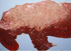 <p>What type of placentitis is this?</p>