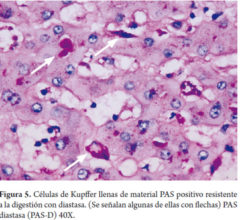 <p><strong>Célula de Kupffer</strong></p>