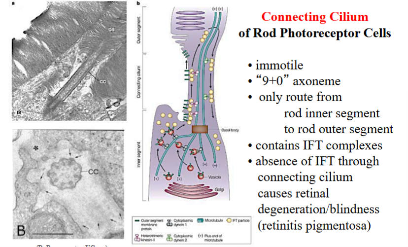 <p><span style="background-color: transparent;">Photoreceptor Cells and the Connecting Cilium</span></p>