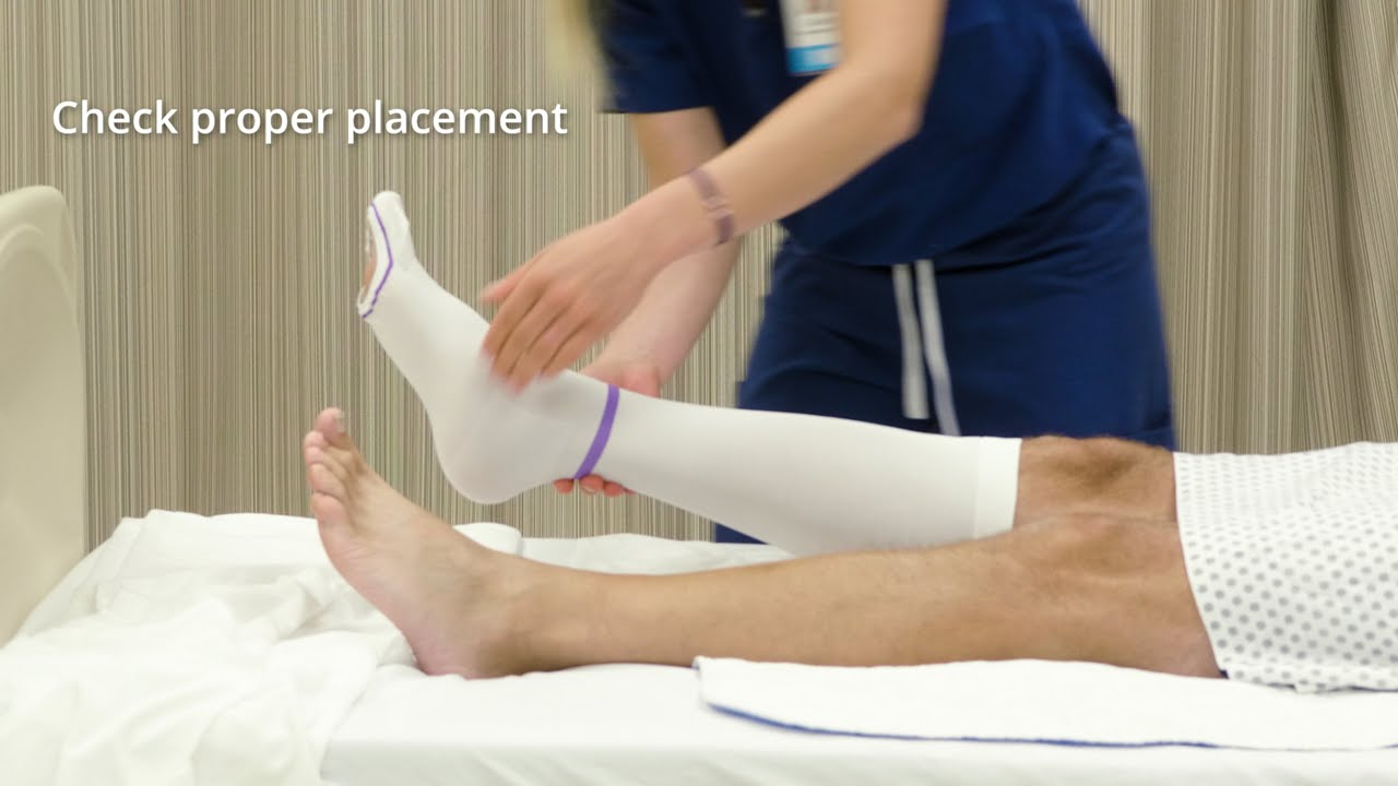<p>Step 5 of skill: After embolic stocking is placed</p>