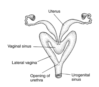 <p>Duplex uterus, two vaginas and two cervices. Some with vaginal sinus.</p>