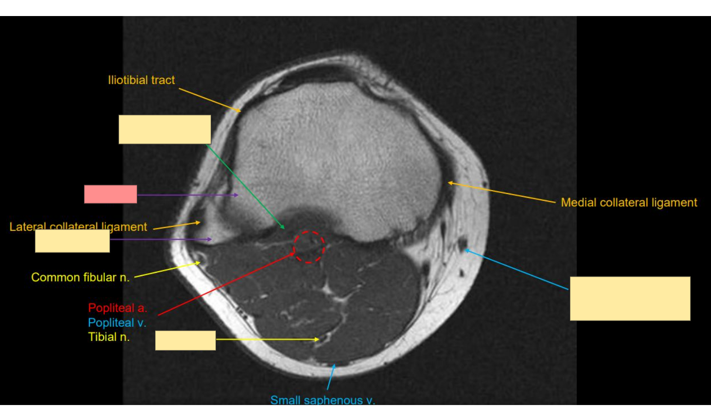 <p>Identify the structure</p>