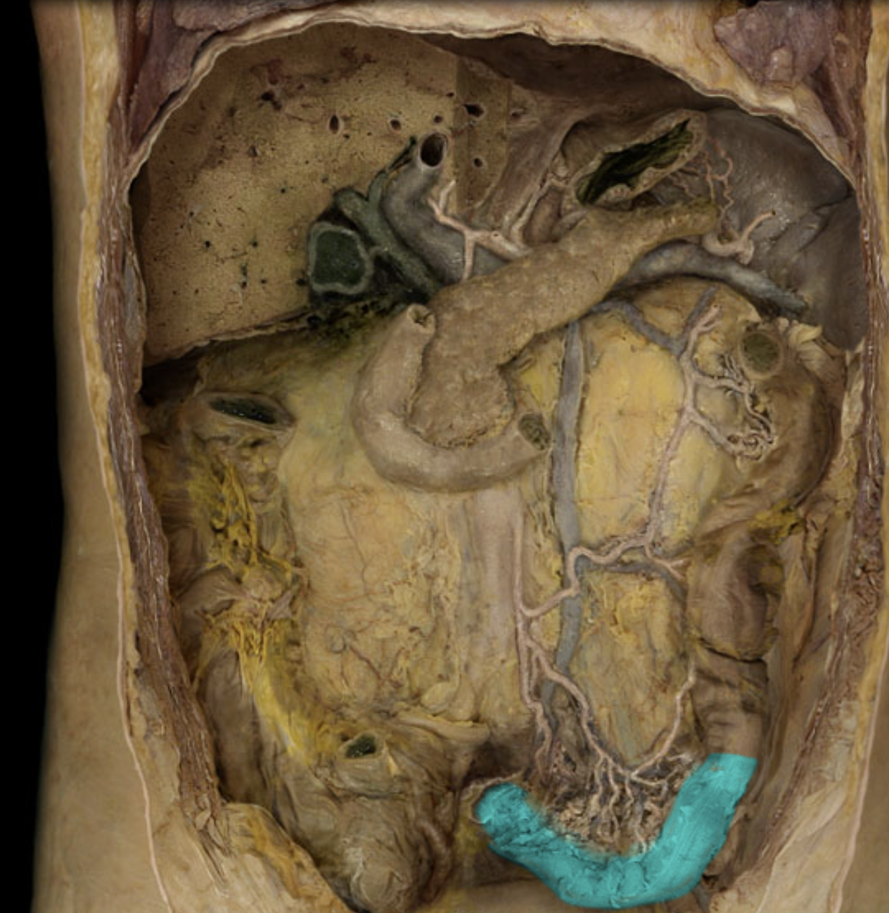 term image