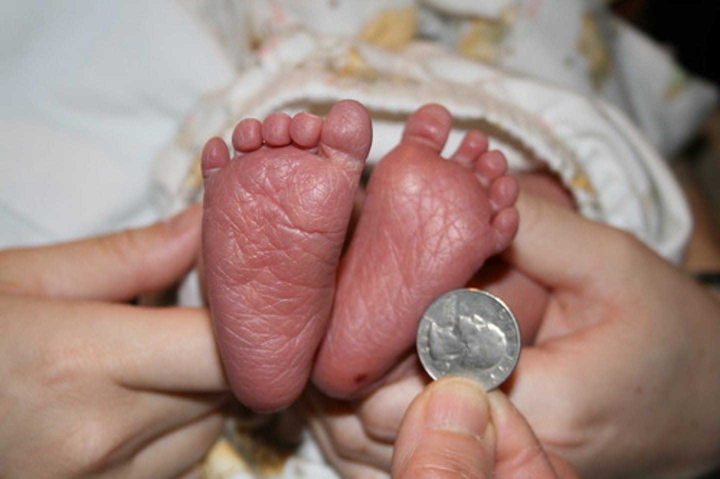 <p>it is small, they are small</p>
