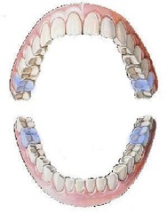 <p>second molars</p>