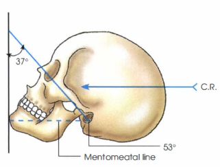<p>Skull projection primarily used to visualize the maxillary sinuses, facial bones, zygomatic arches</p>