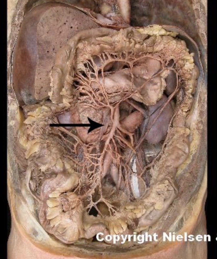 <p>The indicated vessel is the _</p>