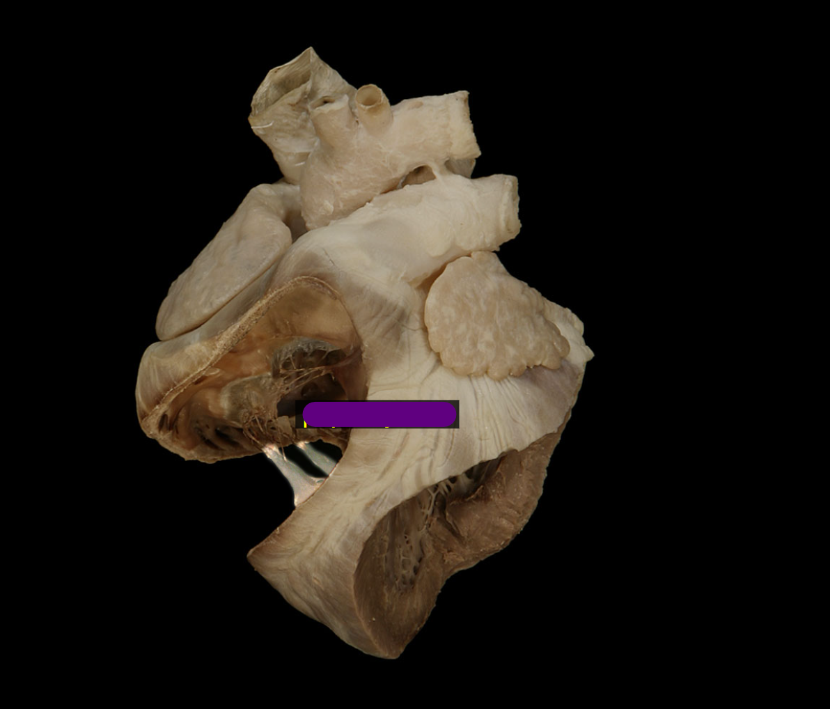 <p>Name the structure and tissue type</p>