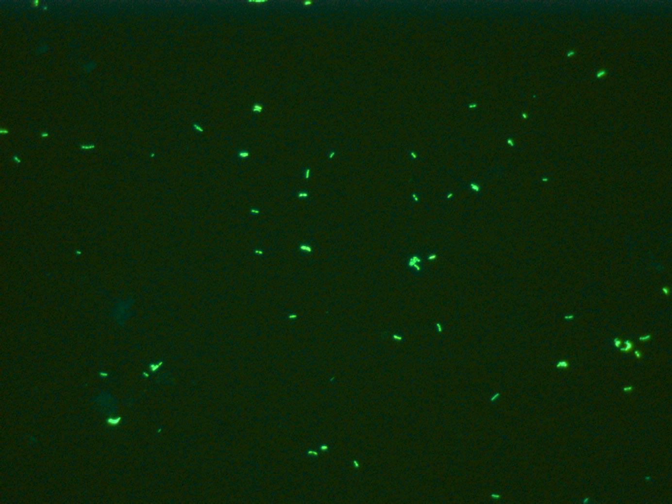 <p class="isSelectedEnd"><em>ZEISS. (n.d.). Detection of acid-fast bacilli [Photomicrograph].</em></p>