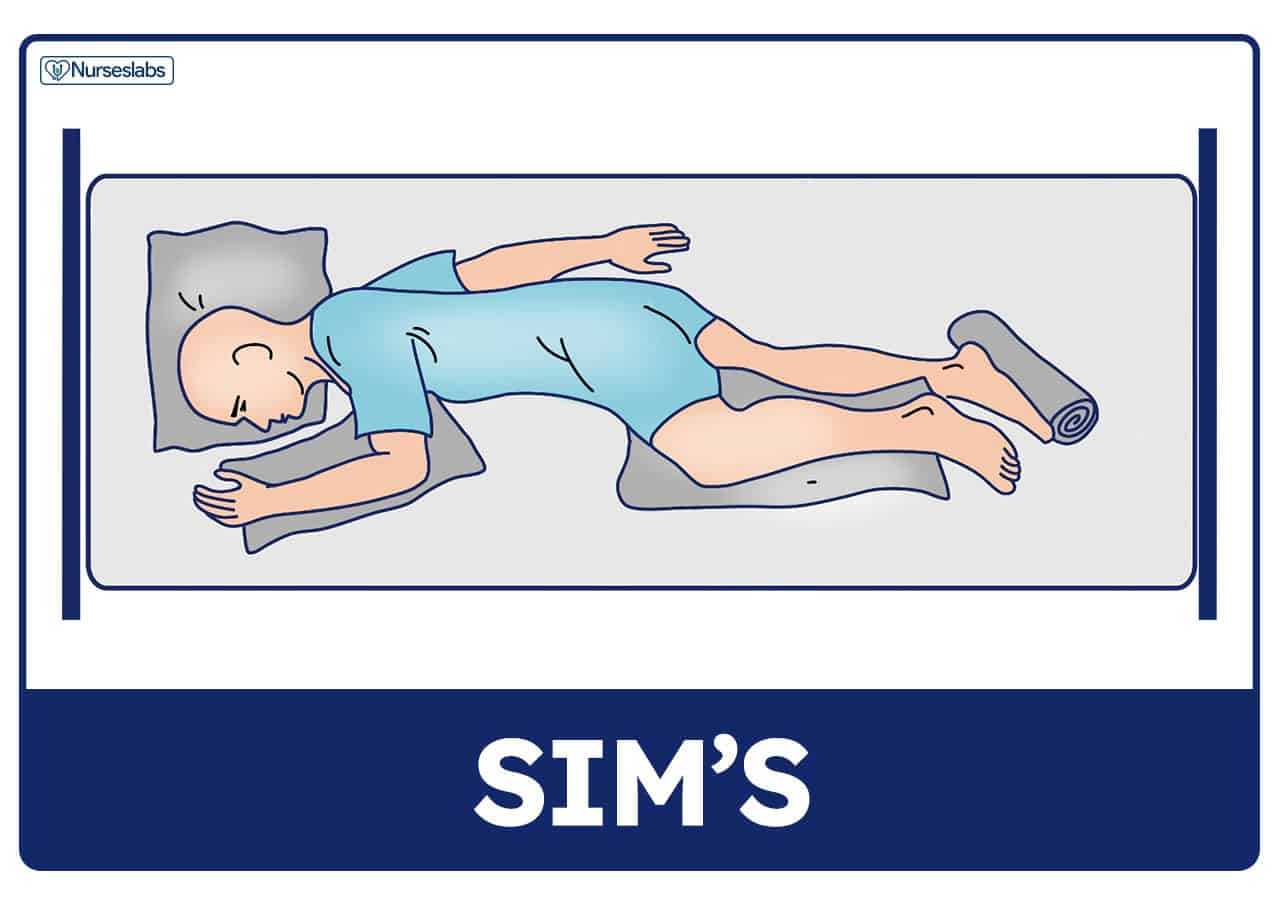 <p>a variation of lateral, lower arm is extended back, upper arm is flexed. upper leg is bent</p><ul><li><p>for rectal procedures or enemas (procedure where <strong>liquid is put into the rectum through the anus to help empty the bowels (poop)</strong></p></li></ul><p></p>