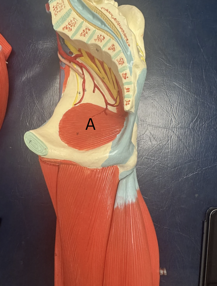 <p>Label this muscle </p>