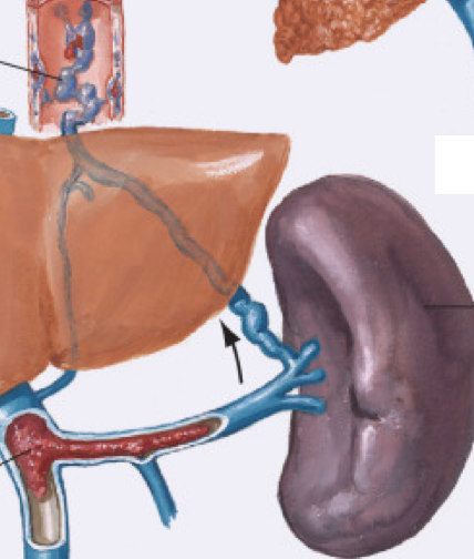 <p>Name three major consequences of portal hypertension. </p><p></p>