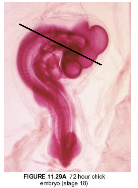 <p>the curvature of the embryo makes it so that some cross-sections will show multiple axial levels at once, and diff slide sets have axial cuts at diff angles</p>