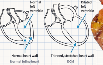 <p>A heart condition where defects <strong>weaken and thin the heart muscles</strong>, directly <strong>hindering effective blood pumping</strong>.</p>