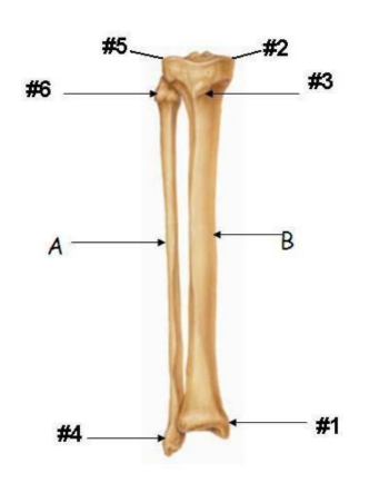 <p>what is #1</p>