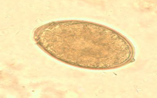 <p><span style="background-color: rgba(0, 0, 0, 0); line-height: 19.7625px;">What is the species in this photo? What type of egg? How do you get infected with it? Common name?</span></p>