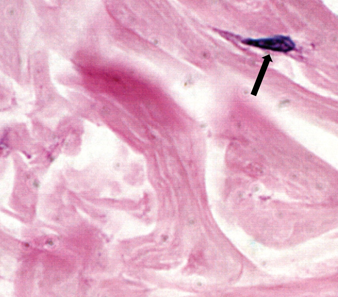 <p>What type of connective tissue is this?</p>